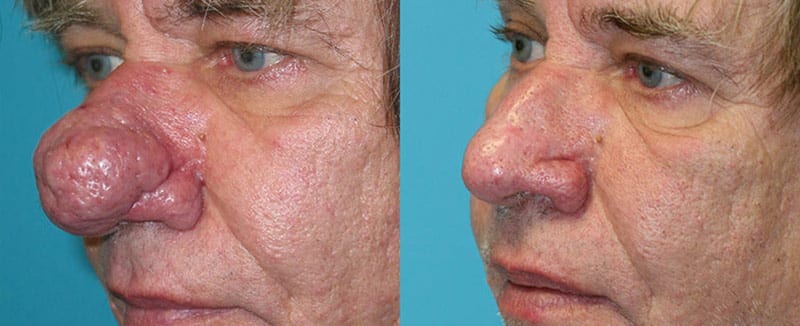 Before and After Image