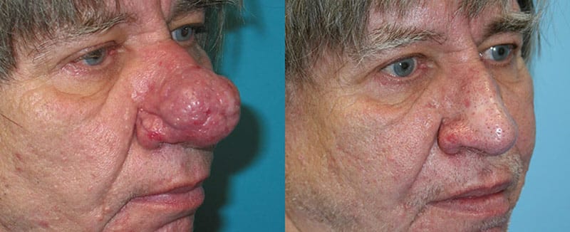 Before and After Image