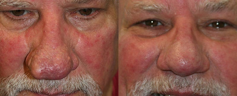 Before and After Image