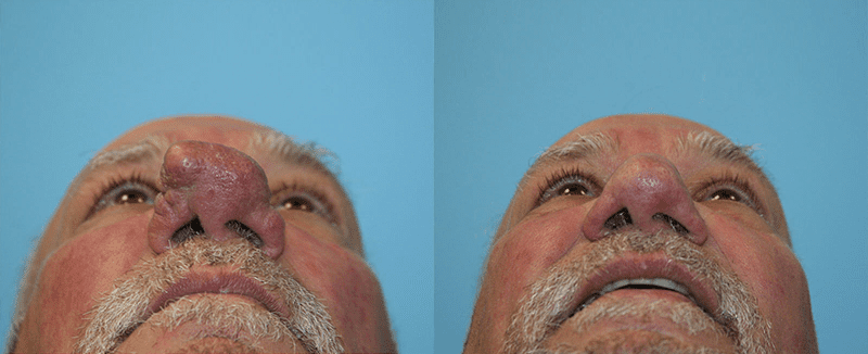 Before and After Image