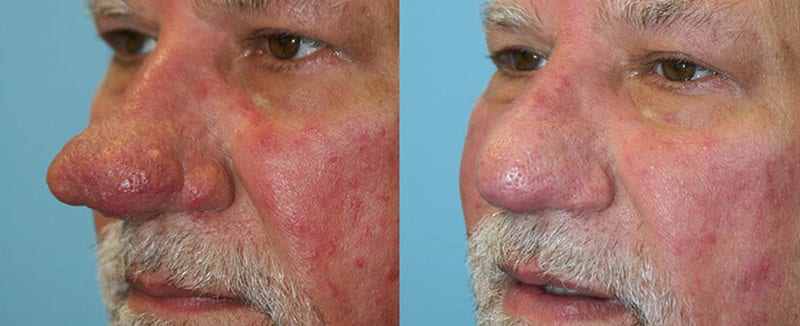 Before and After Image