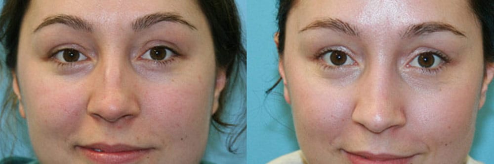 Before and After Image