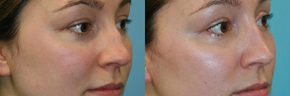 Before and After Image