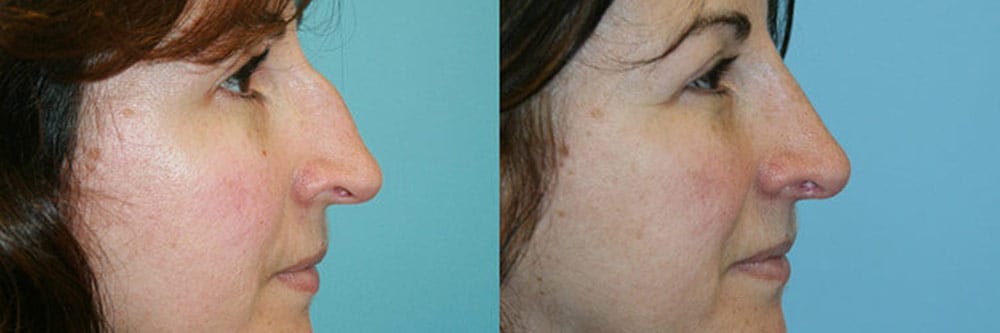 Before and After Image