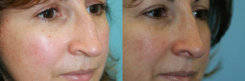 Before and After Image