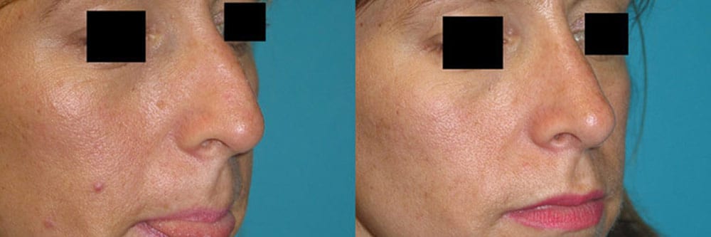 Before and After Image