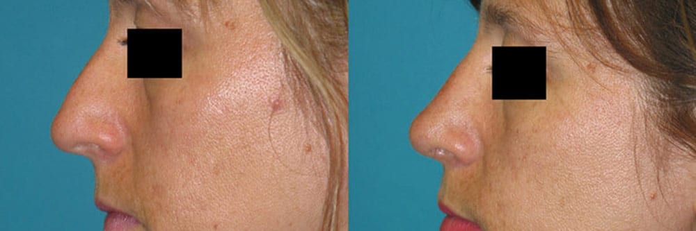 Before and After Image