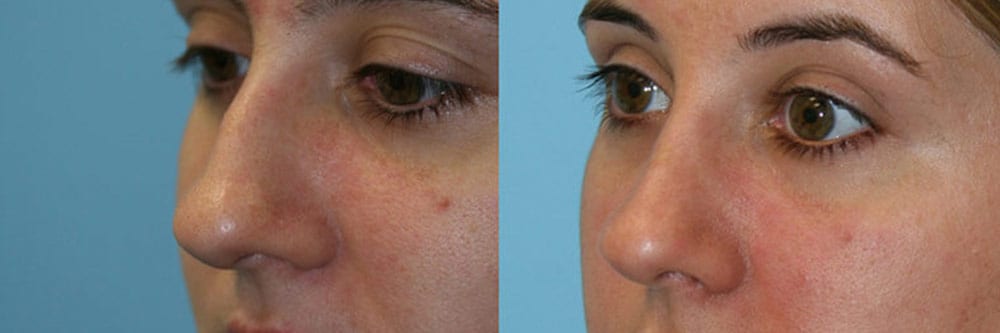 Before and After Image