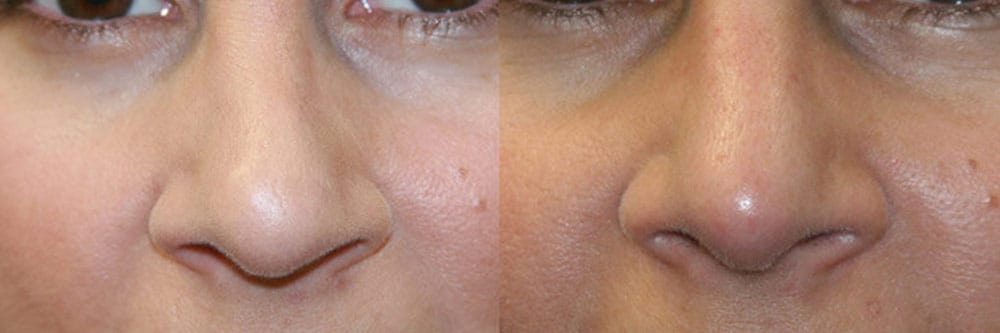 Before and After Image