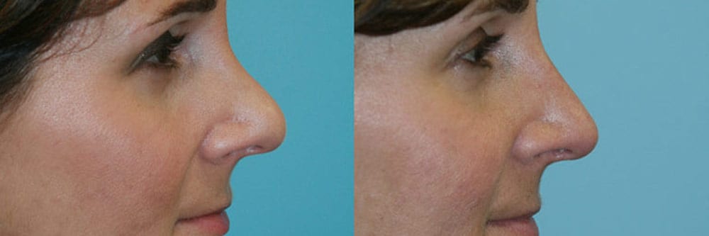 Before and After Image