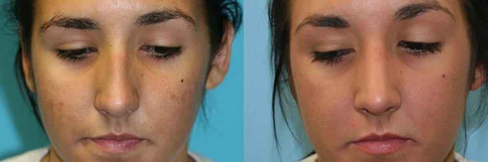 Before and After Image