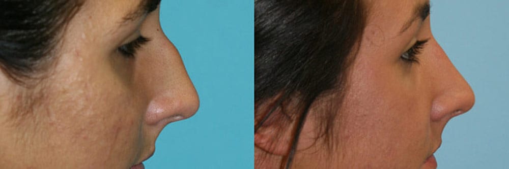 Before and After Image