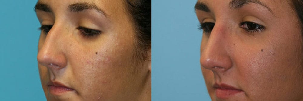 Before and After Image