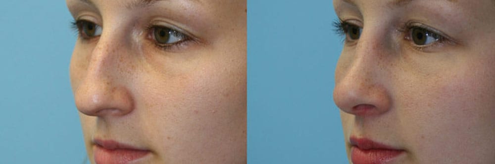 Before and After Image