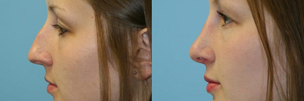 Before and After Image