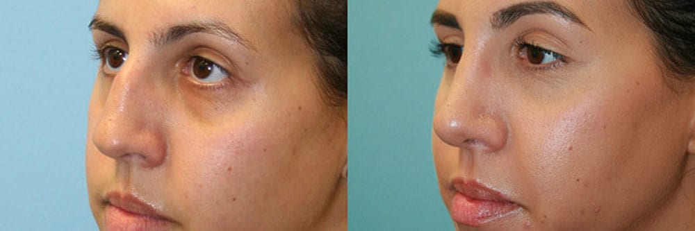 Before and After Image