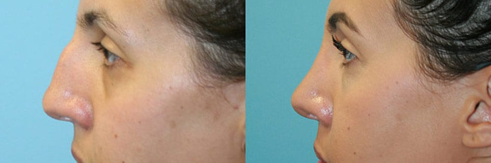 Before and After Image