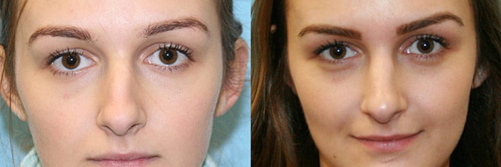 Before and After Image