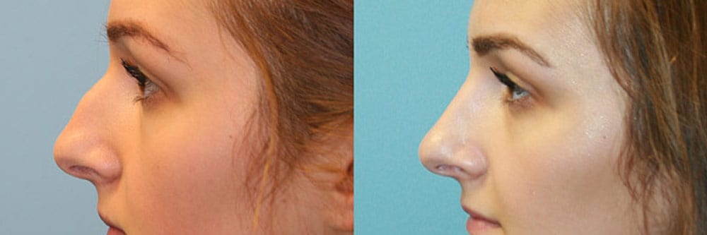 Before and After Image