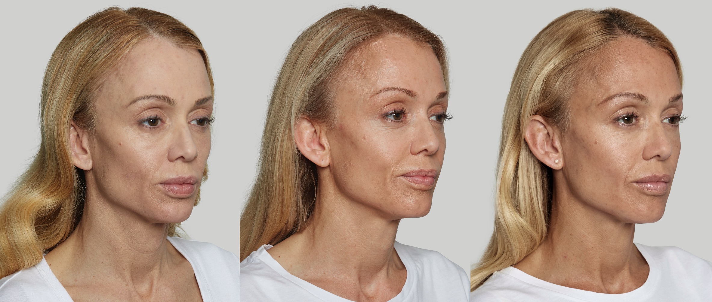 Before and After Image