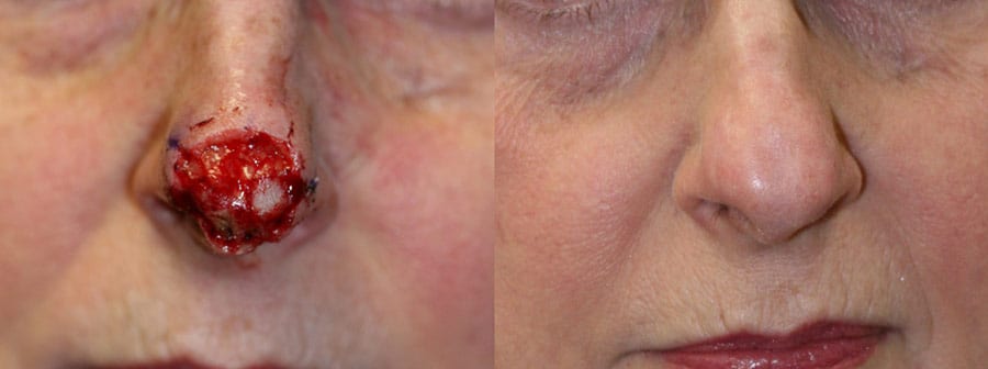 Before and After Image