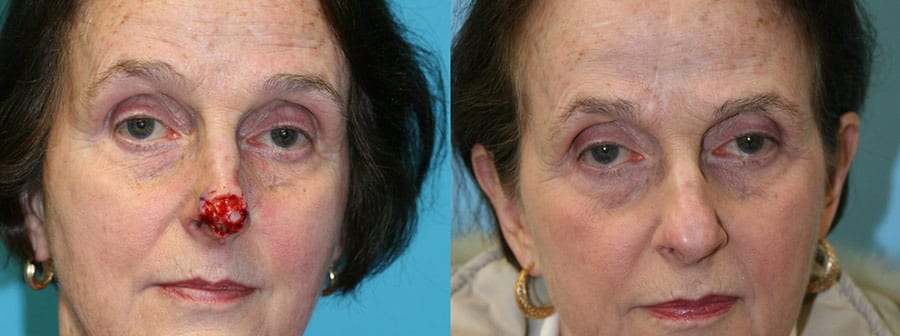 Before and After Image