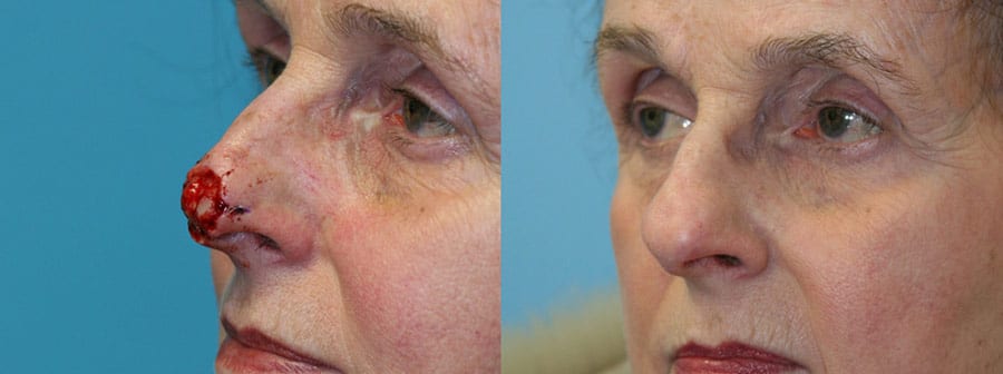 Before and After Image