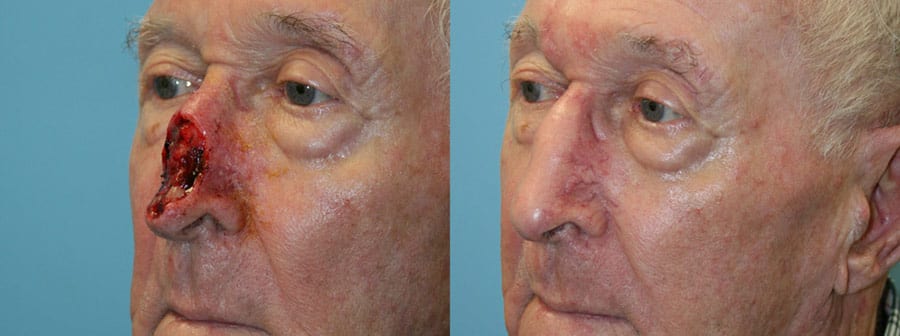 Before and After Image