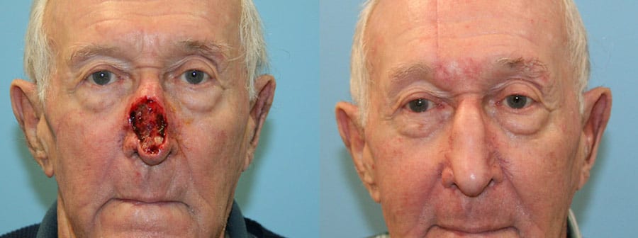 Before and After Image