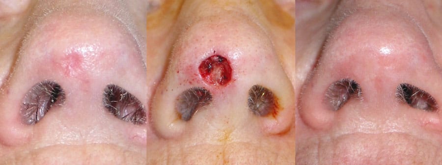 Before and After Image