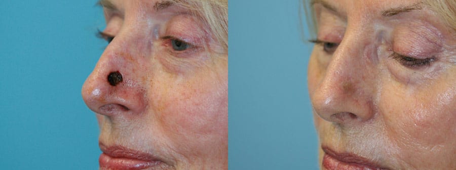 Before and After Image