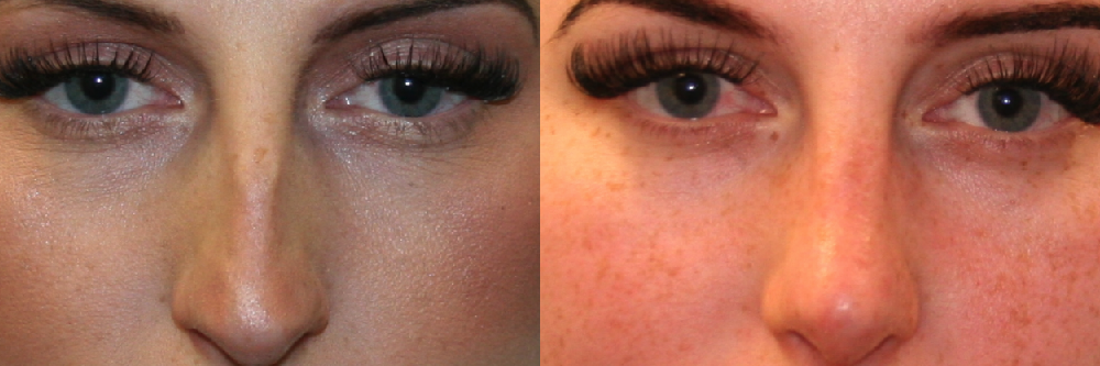 Before and After Image