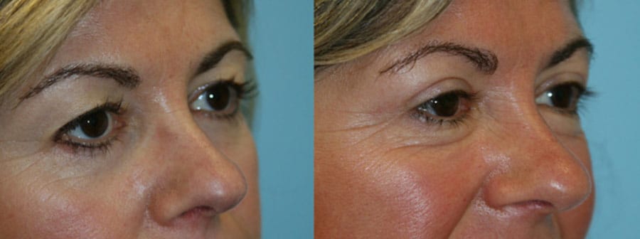 Before and After Image