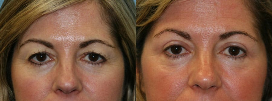 Before and After Image