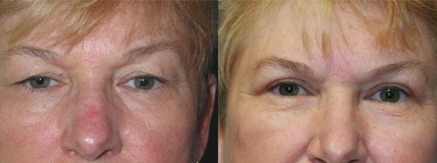 Before and After Image