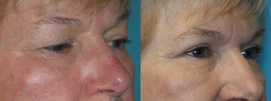 Before and After Image