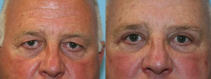 Before and After Image