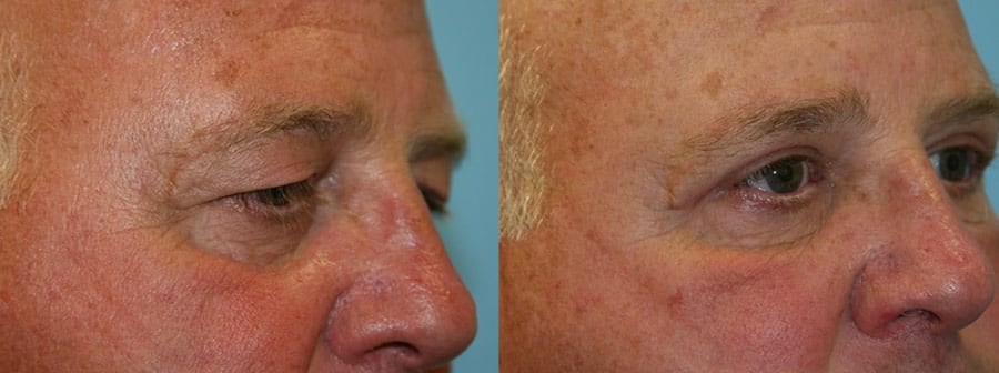 Before and After Image