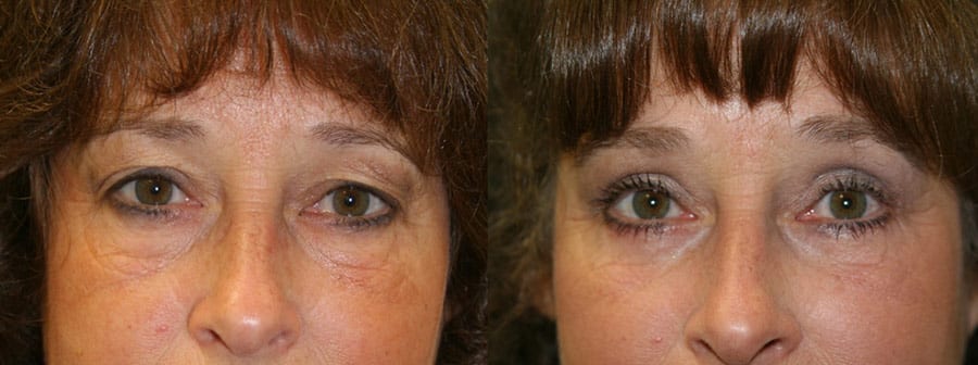 Before and After Image