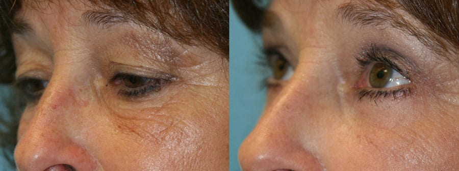 Before and After Image