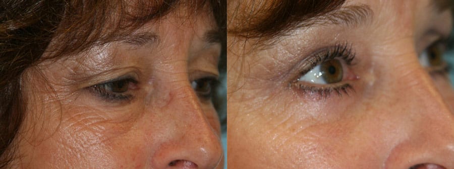 Before and After Image