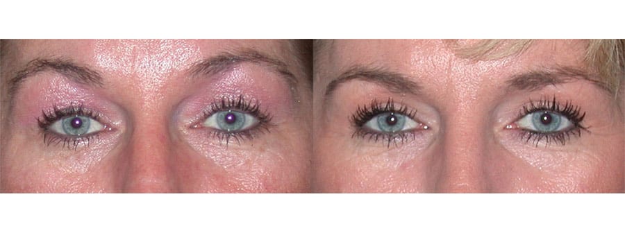 Before and After Image