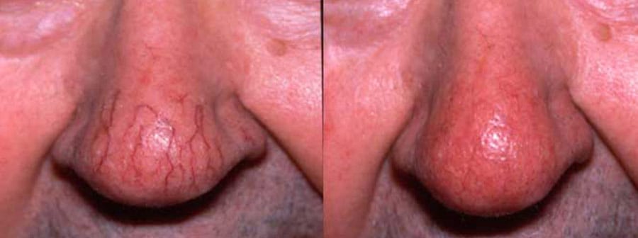 Before and After Image