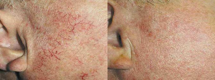 Before and After Image