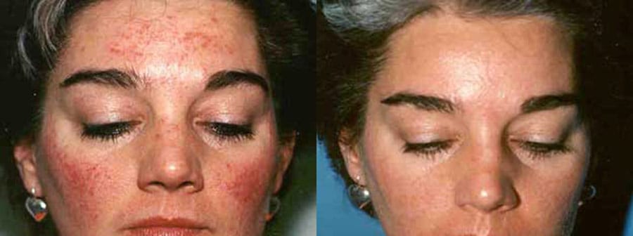 Before and After Image