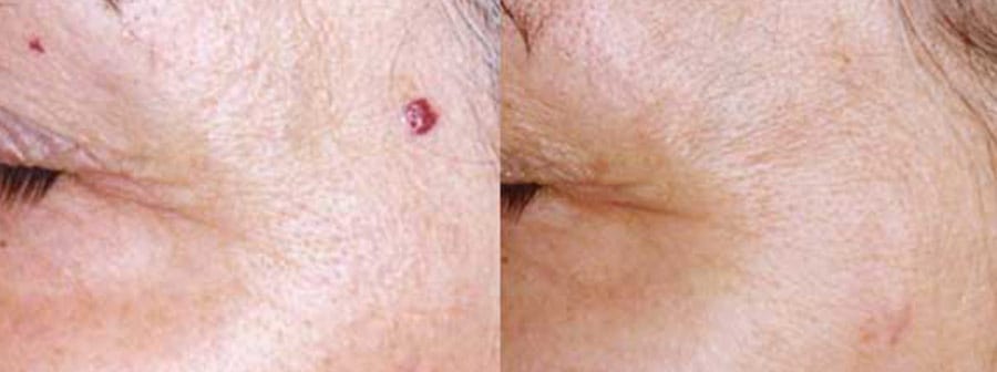 Before and After Image