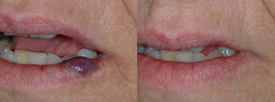 Before and After Image