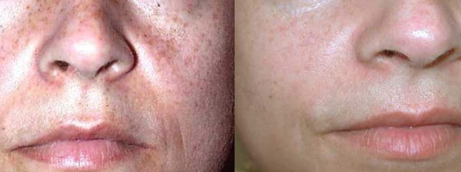 Before and After Image