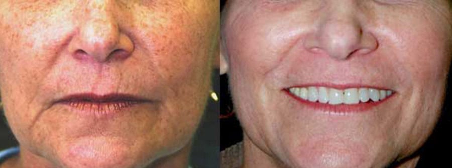 Before and After Image